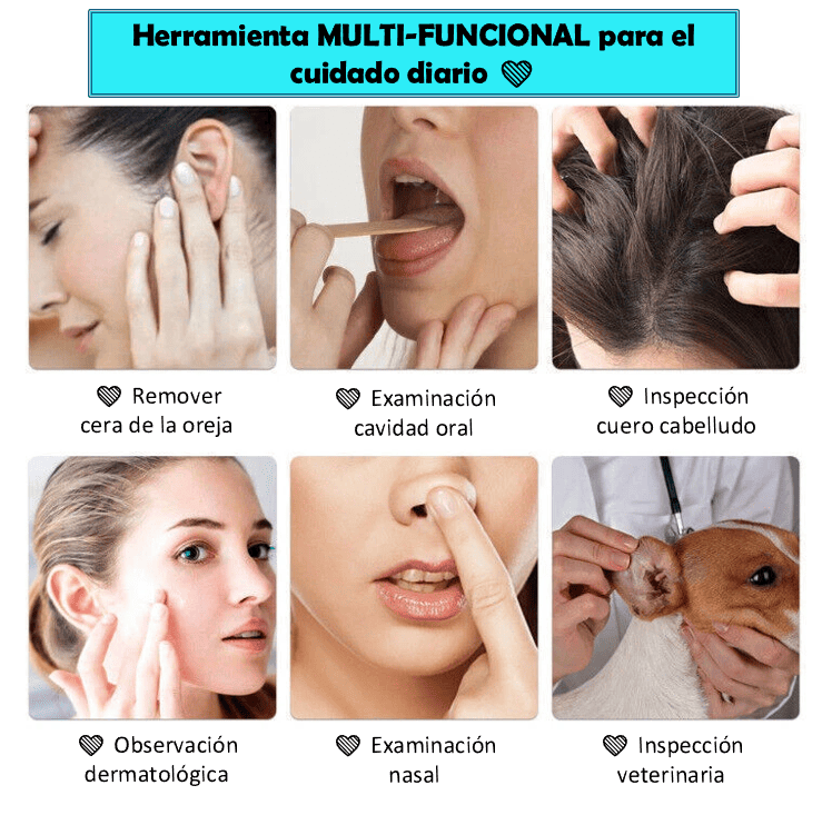 🦻ClearView Pro™ Limpiador de oídos inteligente con cámara HD