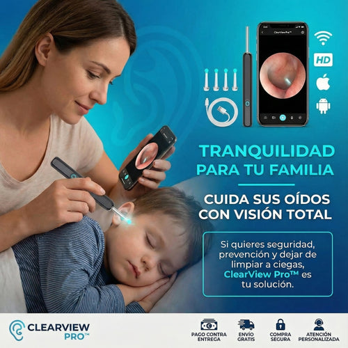 🦻ClearView Pro™ Limpiador de oídos inteligente con cámara HD